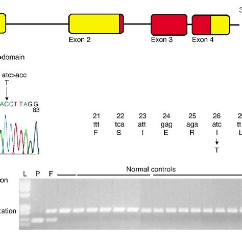 Schematic Of The Hesx Gene Hesx I T Mutation And Bsu I