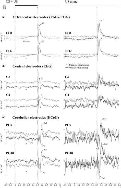 Electrophysiological Activity From Over The Cerebellum And Cerebrum