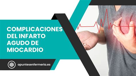 Complicaciones Del Infarto Agudo De Miocardio Apuntes Enfermería