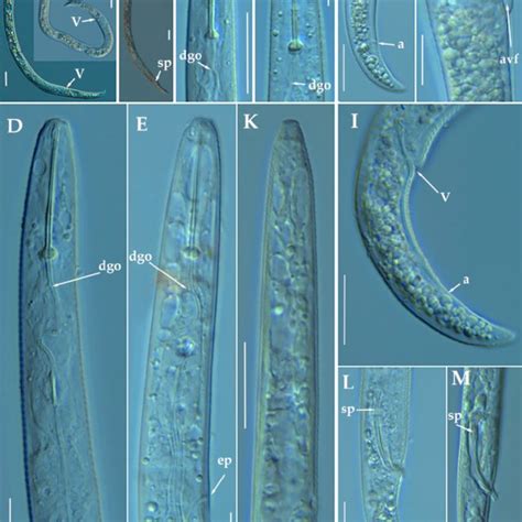 Light Photomicrographs Of Paratylenchus Caravaquenus Sp Nov A B