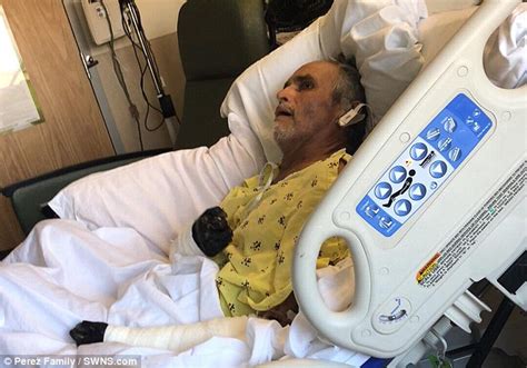 Nj Man 60 Who Contracted Flesh Eating Bacteria Being Transferred To A