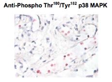 Anti P Mapk Phospho Thr Tyr Antibody Gtx Genetex