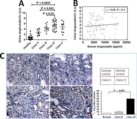 Capacity Of Urinary Angiostatin To Reflect Renal Pathology In Lupus