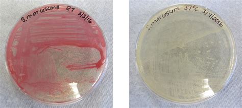 Structure And Function Of Cellular Genomes Microbiology Study Guides