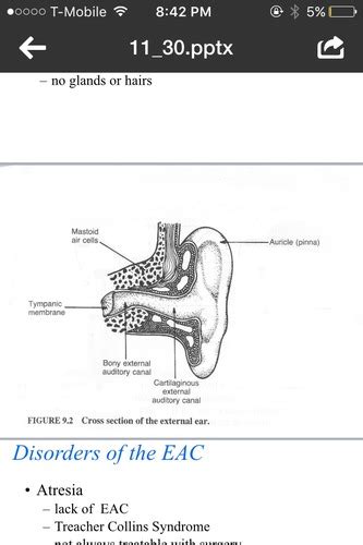 Chapter Human Ear And Simple Test Hearing Flashcards Quizlet