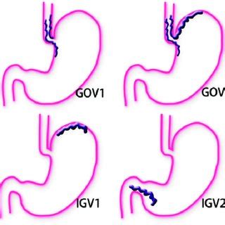 Drawing Illustrates The Portal And Systemic Venous Pathways