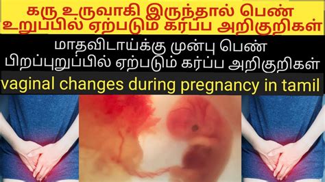 Changes In Vaginal During Pregnancy Early Symptoms Of Pregnancy