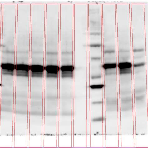 Phoretix1D Automatic SDS PAGE And Western Blot Analysis Software