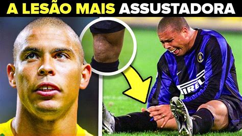 A Lesão que Quase Acabou a Carreira de Ronaldo Fenômeno iMove Web