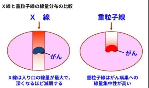 日本qst医院：日本重离子治疗领航者，为肿瘤患者带来新希望！ 厚朴方舟