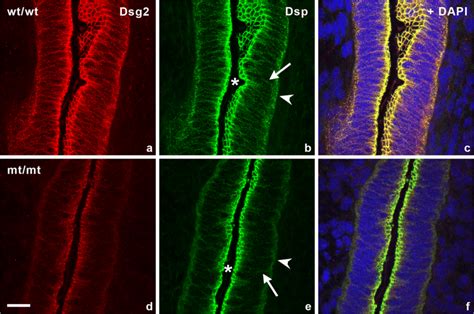 Immunofluorescence Staining Of Luminal Endometrial Epithelial Cells