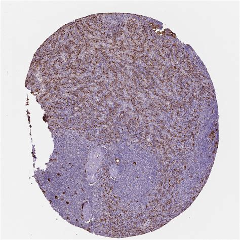 Tissue Expression Of Cd68 Staining In Spleen The Human Protein Atlas