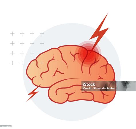 traumatic brain injury tbi icon stock illustration  image