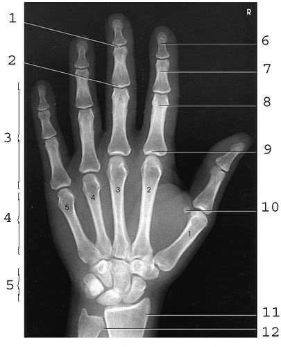 Unit 3 Computer Lab Upper Extremities Anatomy Flashcards Quizlet