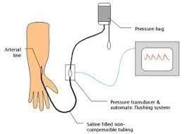 Blood Pressure Flashcards Quizlet