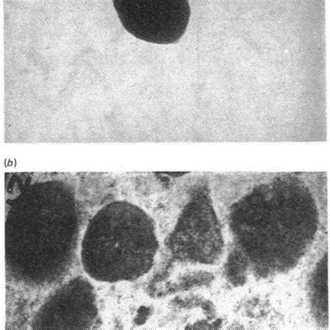 Electron Micrographs Of Prochymosin Inclusion Bodies Isolated From E