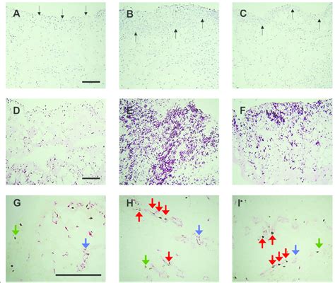 Effects Of Selective Tropomyosin Receptor Kinase A Trka Inhibitor