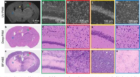 Deep Learning Enables Ultraviolet Photoacoustic Microscopy Based