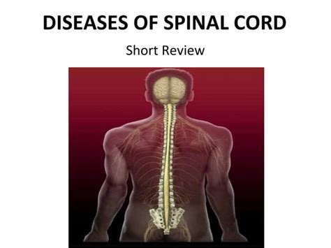 Spinal Cord Diseases | PPT