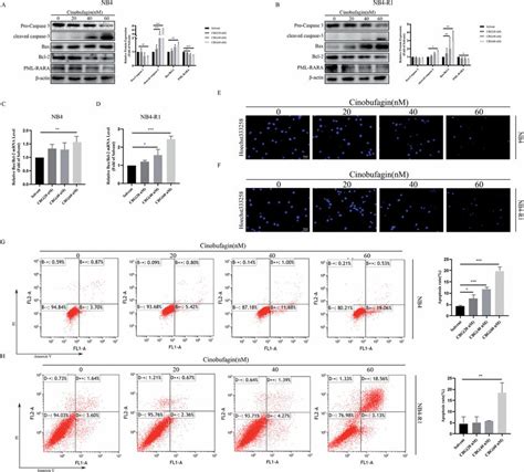 CBG Induced Apoptosis Of NB4 And NB4 R1 Cells A B NB4 And NB4 R1