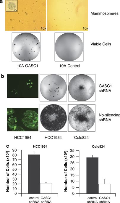 Mammosphere Formation Assay Of Mcf10a Gasc1 And Mcf10a Control Cells