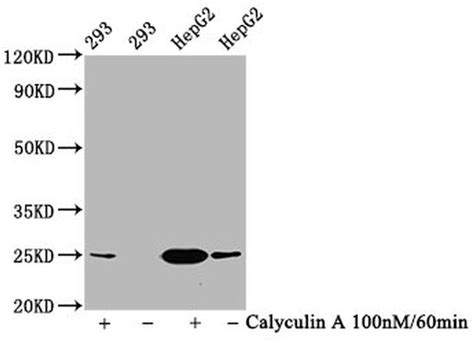 Phospho Eif4e Ser209 Recombinant Monoclonal Antibody 1f3 Ma5 33134