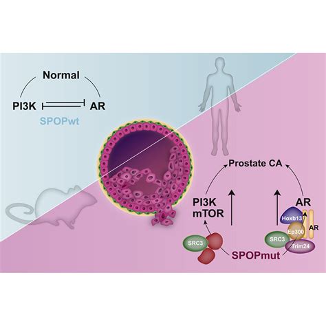 Spop Mutation Drives Prostate Tumorigenesis In Vivo Through Coordinate