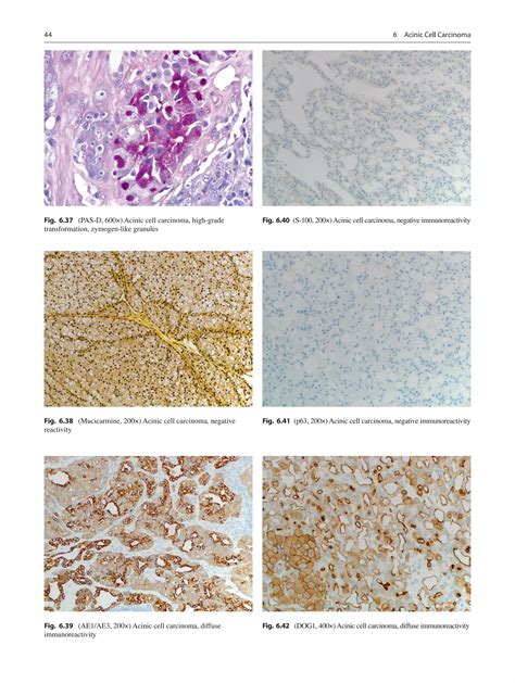 Atlas Of Salivary Gland Pathology PDF