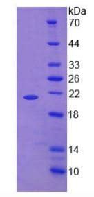 Recombinant human TNF alpha protein His tag ab270587 アブカム