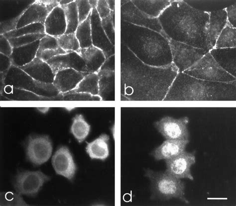 Effect Of Lmb On The Subcellular Distribution Of Endogenous P120 Ctn