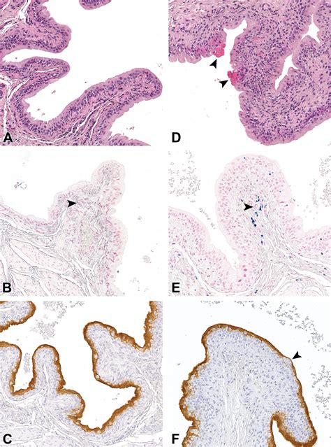 Characterization Of Urothelial Inclusions In Male Wistar Han Rats