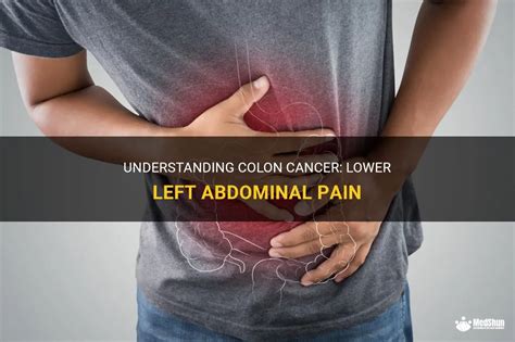 Understanding Colon Cancer: Lower Left Abdominal Pain | MedShun