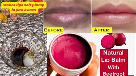 Apply This👆lipbalm On Drychappeddarkpigmented Lips To Get Soft Pink