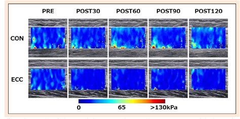 Pdf Passive Muscle Stiffness Of Biceps Femoris Is Acutely Reduced