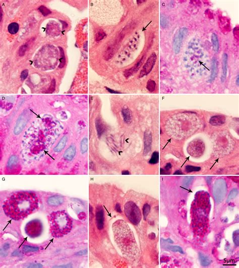 Isospora Belli Life Cycle