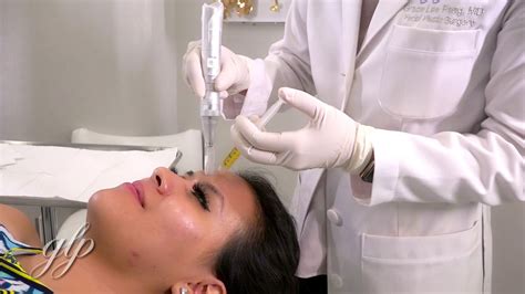 Dr Grace Peng Prp With Micro Needling Demo Youtube