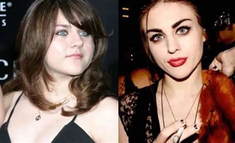 Frances Bean Cobain Nose Job Plastic Surgery Before And After Celebie