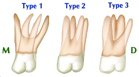 External And Internal Root Canal Anatomy Of The First And