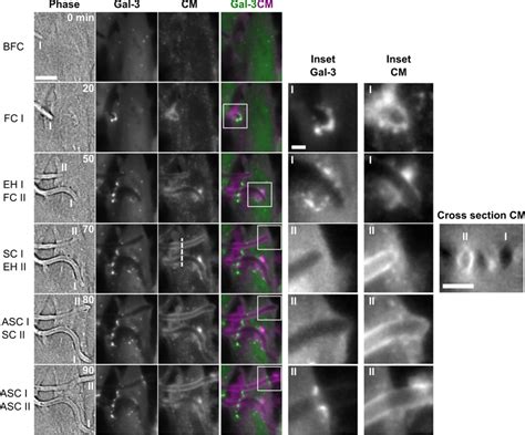 High Resolution Live Cell Imaging Of Two C Albicans Hyphae Invading A Download Scientific