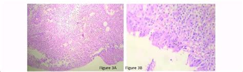 Colonic Biopsy Images Hande Stain 10x Figure 3a And 40x Figure 3 B Download Scientific