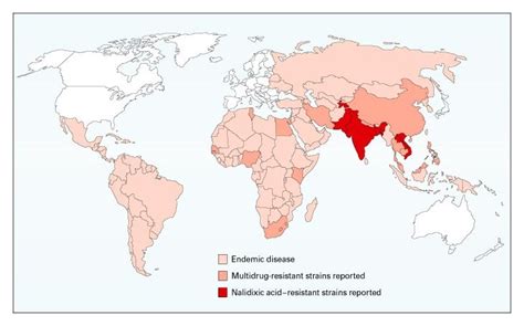 Typhoid Fever Nejm