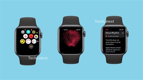 What is Apple Watch ECG, How Does it Work, and How do You Set it Up ...