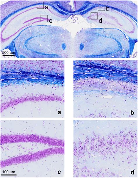 Illustrative Cresyl Violet And Luxol Fast Blue Section Of The Brain