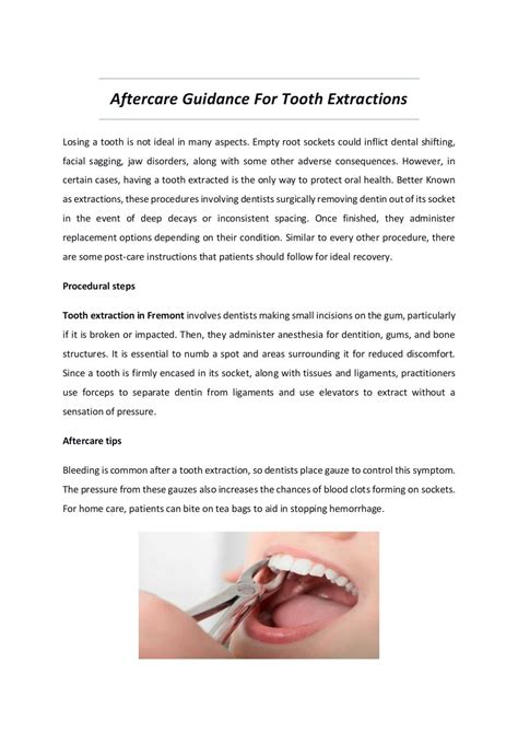 Aftercare Guidance For Tooth Extractions