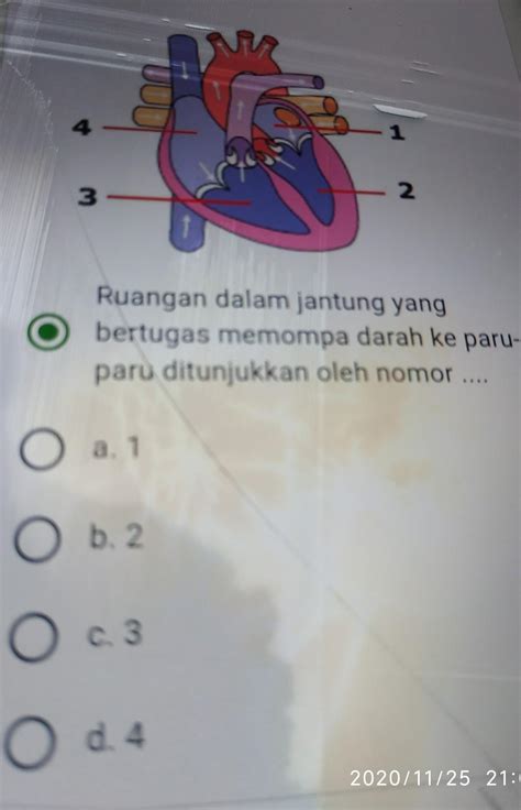 Ruangan Dalam Jantung Yang Bertugas Memompa Darah Ke Paru Paru Megan