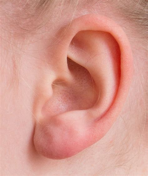 17 Proven Home Remedies For Clogged Ears Healthyline