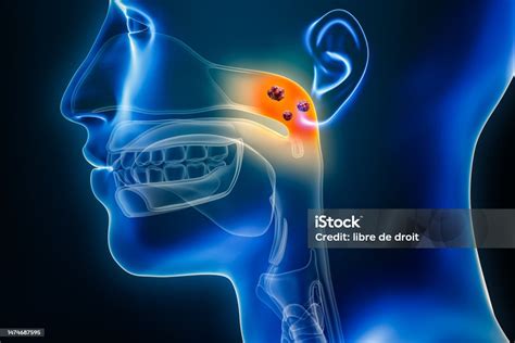 Nasopharynx Cancer With Organs And Tumors Or Cancerous Cells 3d Rendering Illustration Anatomy