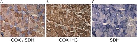 Histochemical And Immunohistochemical Assessment Of Mitochondrial