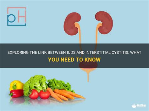 Exploring The Link Between Iuds And Interstitial Cystitis What You