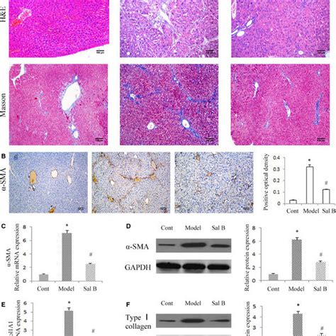 Effects Of Sal B On Carbon Tetrachloride Ccl Induced Liver Fibrosis